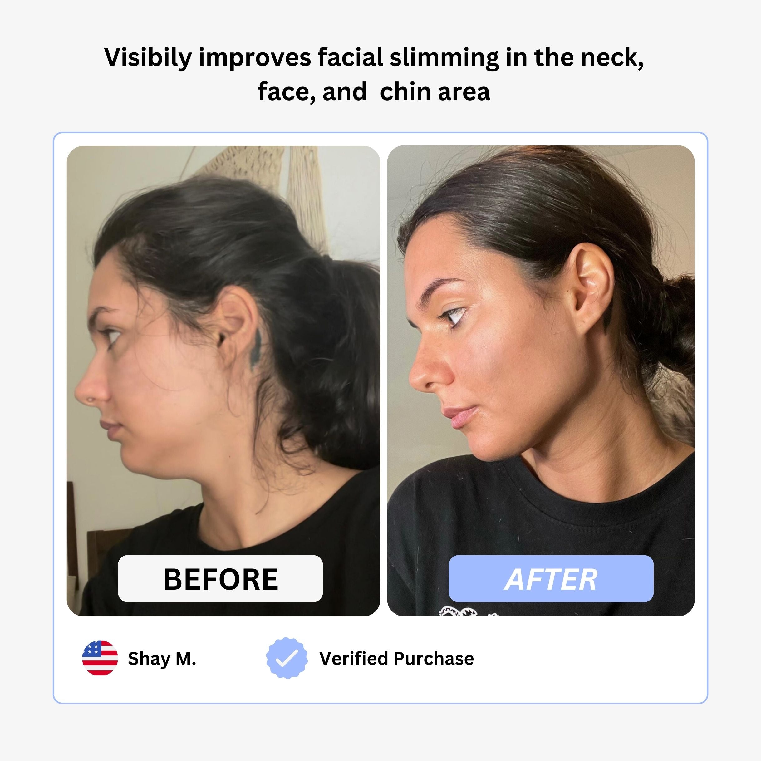 True Beauty Glow Device