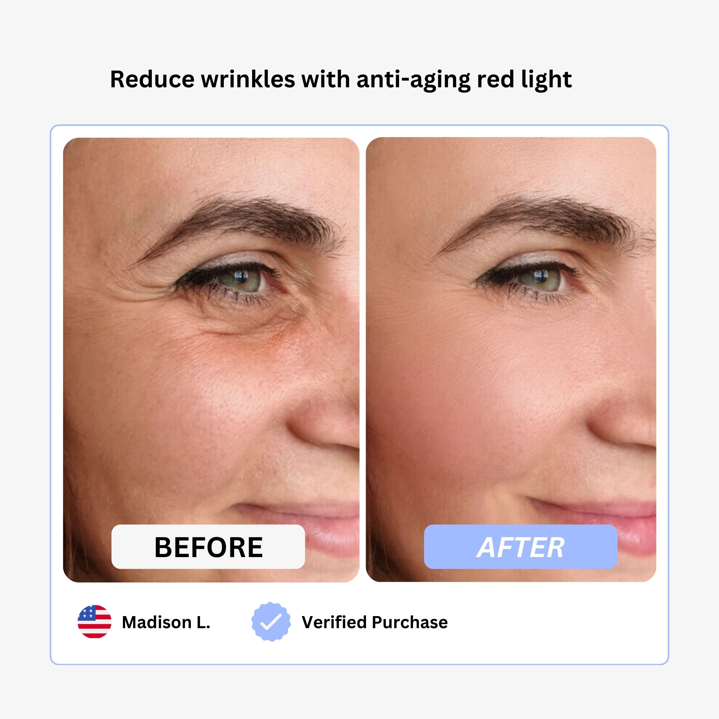True Beauty Glow Device