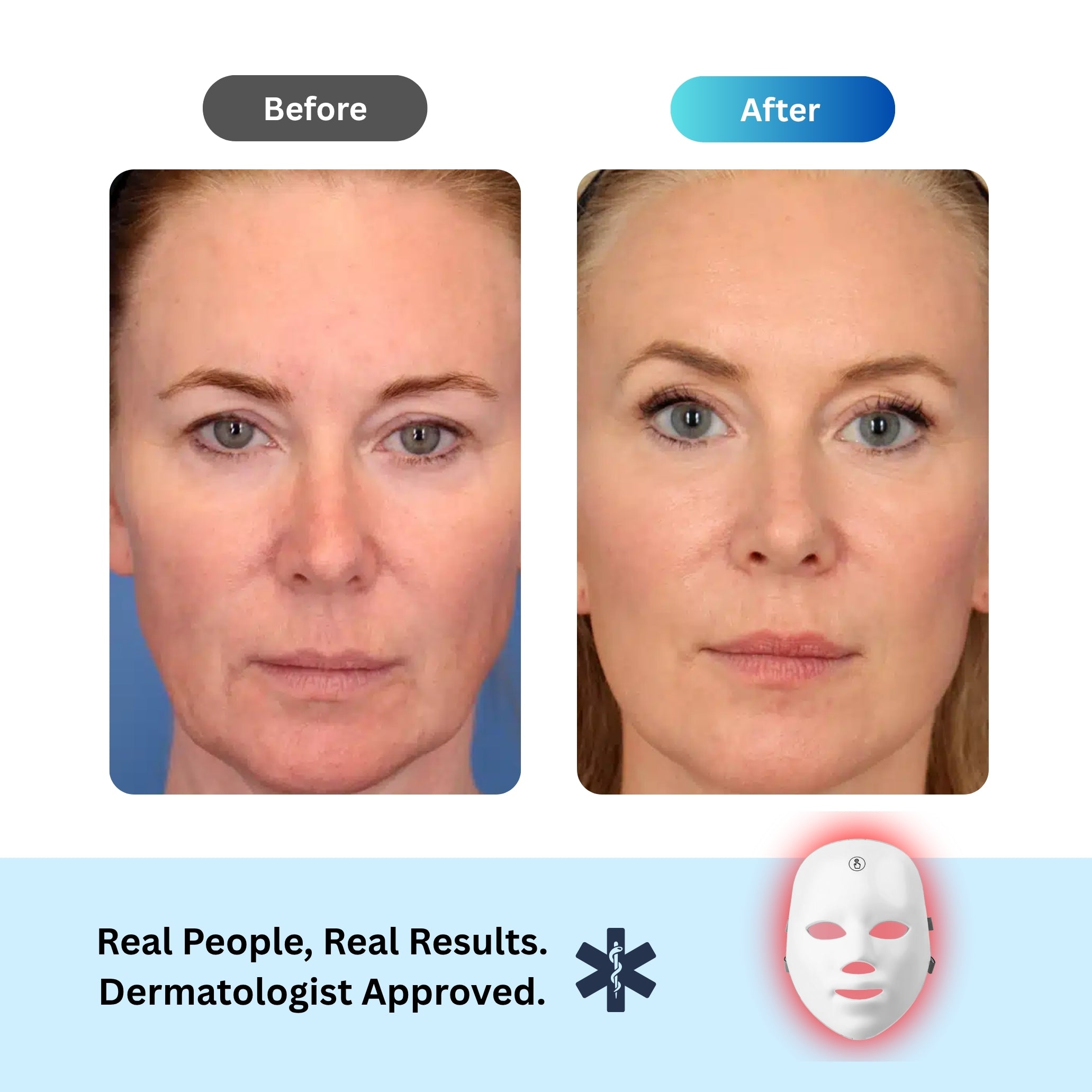 Anti-Aging Red Light Mask