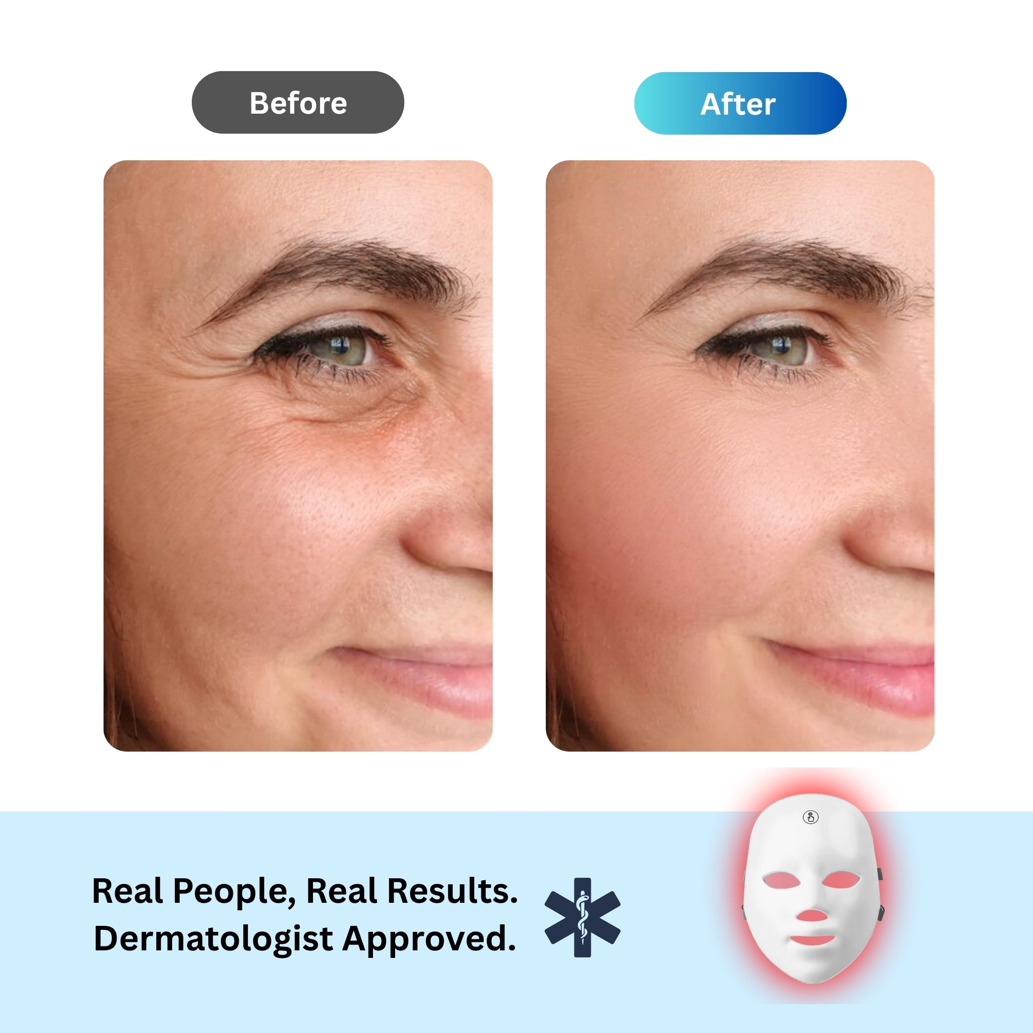Anti-Aging Red Light Mask